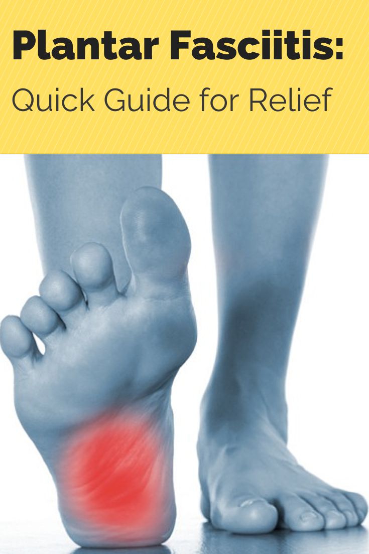 guide to treating plantar fasciitis