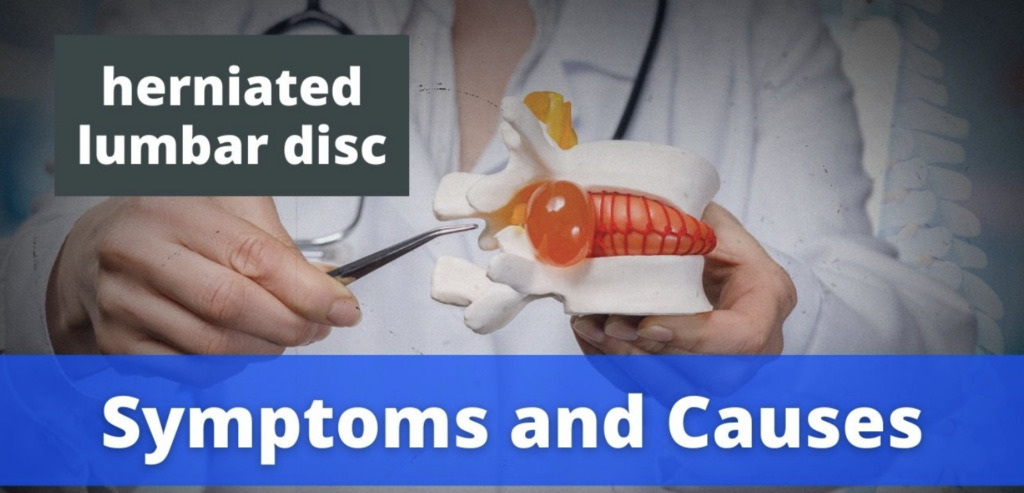 symptoms of herniated disc